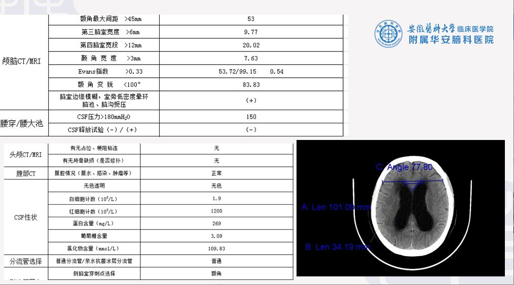 山东患者慕名跨省求医，华安脑科妙手施术