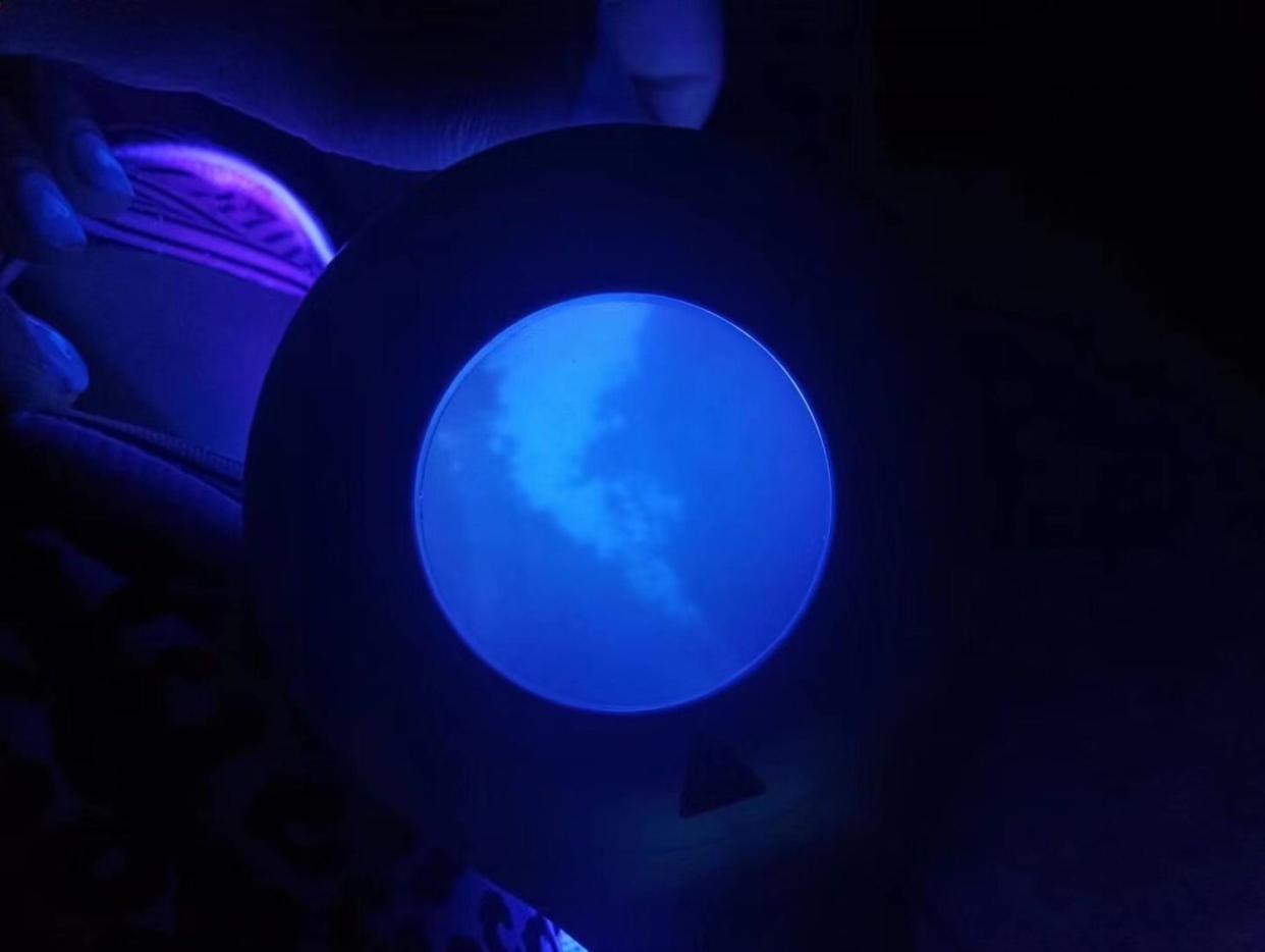 成年人脸部白斑怎么治疗最有效,儿童面部白斑消除最简单方法