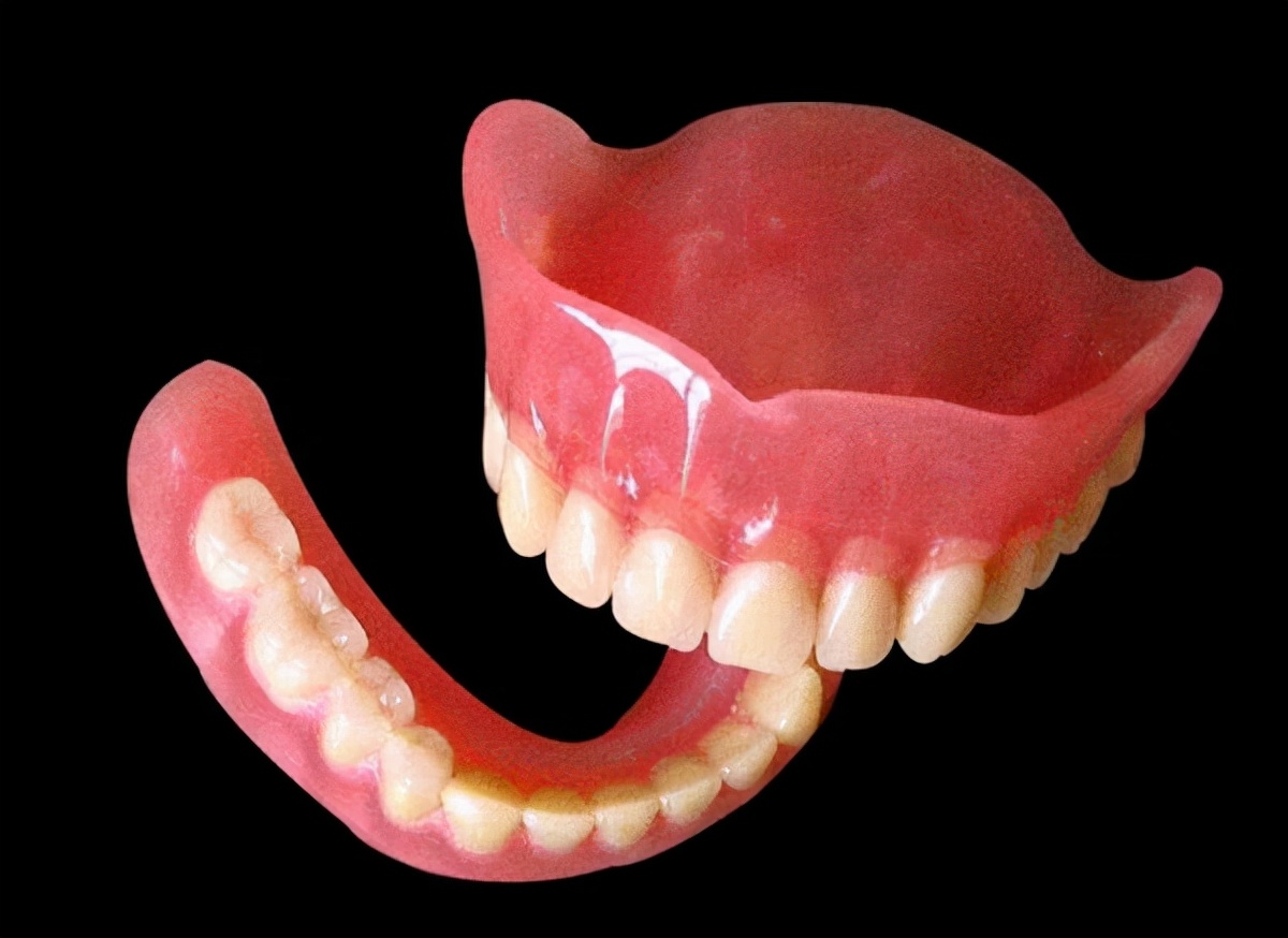 牙齿松动缺失全口修复要多少钱,种植牙之后全口牙齿松动怎么回事