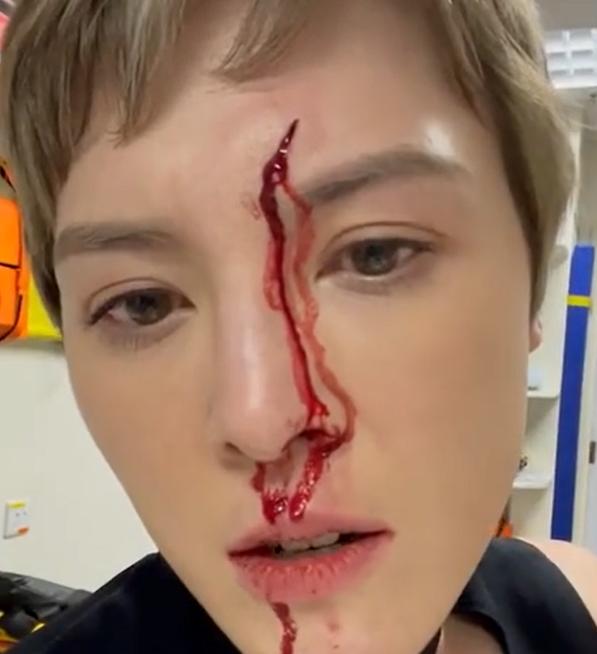 31岁知名女明星出车祸,31岁女演员车祸