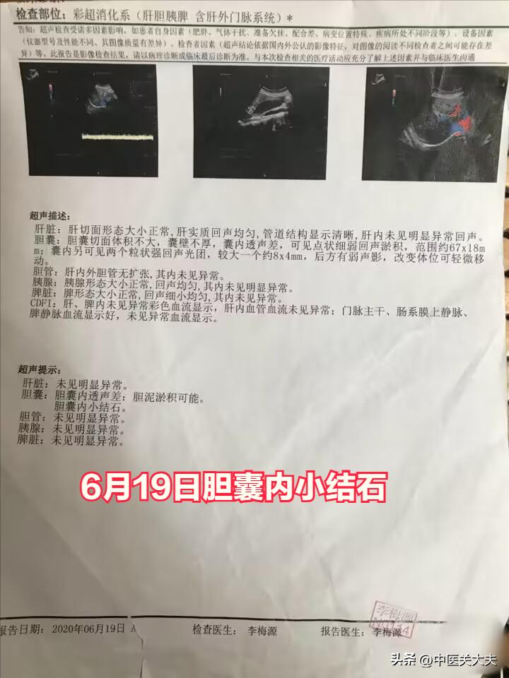 产妇为什么得胆囊炎胆囊结石,孕晚期有胆囊炎胆囊结石怎么办