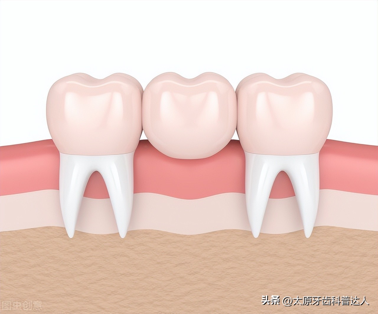 牙齿缺失严重如何补牙,牙齿缺失如何矫正