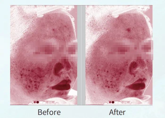 让你又爱又恨的面霜,让人们又爱又恨的软件