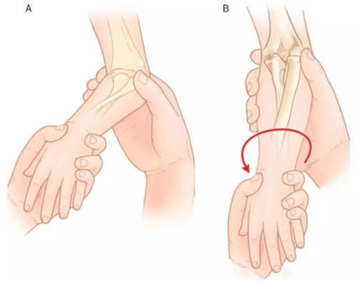 锻炼受伤后要注意什么好,锻炼如何避免拉伤
