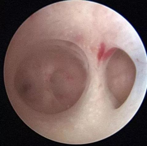 如果想要好孕需要注意哪些细节呢,想要好孕这些问题千万得注意