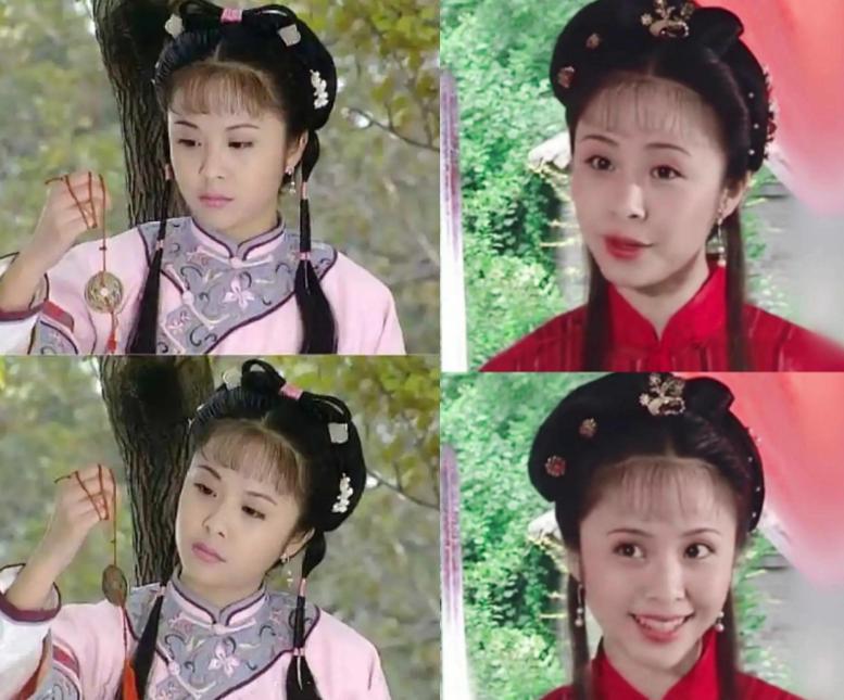 最近脸僵硬的女星,脸部变僵硬的女明星