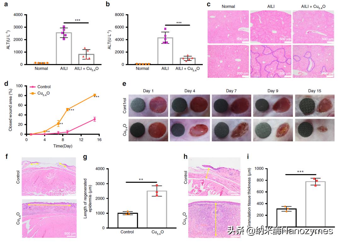 Nat.Commun.|超小铜基纳米酶清除活性氧及缓解炎症相关疾病