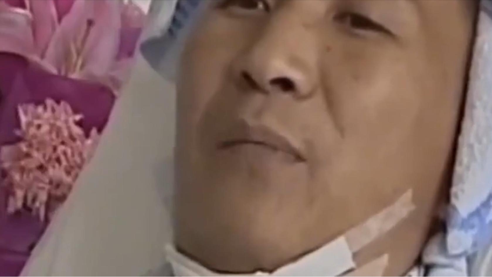 云南男子口臭手术后现在怎么样了,云南男子口臭查出了大毛病