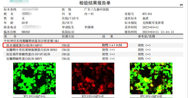 罕见病突发全身瘫痪只有头能动,双腿瘫痪还能治好吗