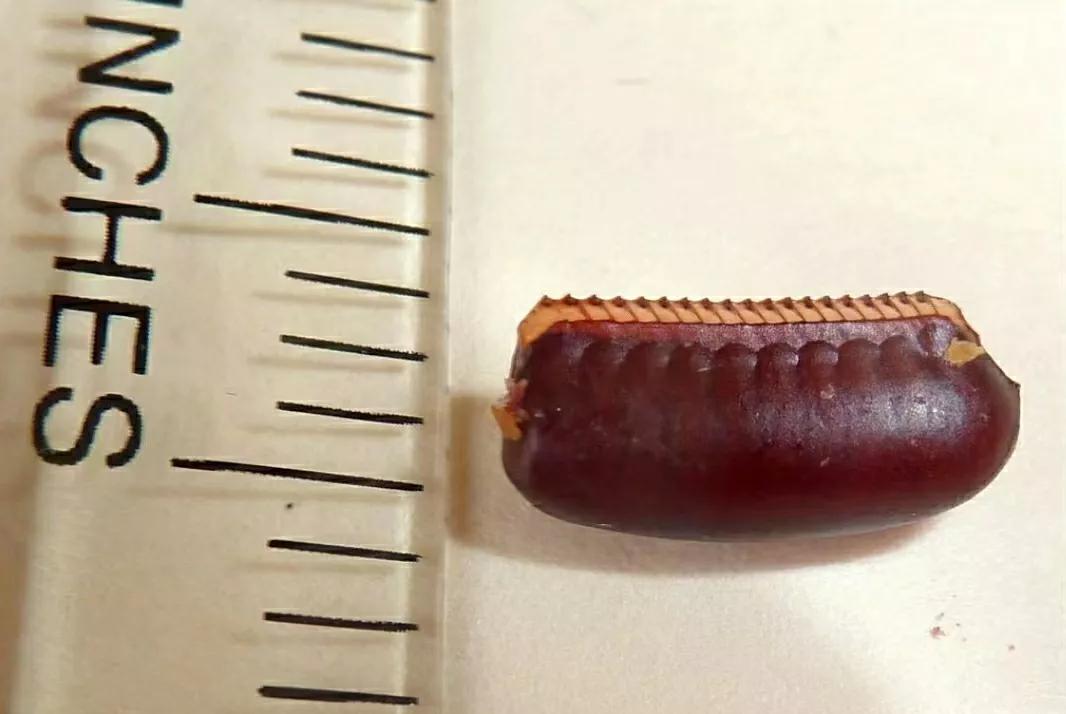 西安市哪些机构专门除蟑螂,西安除蟑螂虫子电话