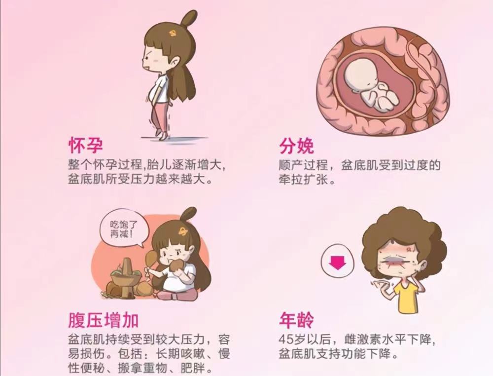 画“厕”为牢——关于女性“漏尿”的那些事