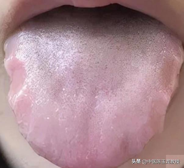 胃病引起的腹泻吃什么药管用,老中医治腹泻最快的方法