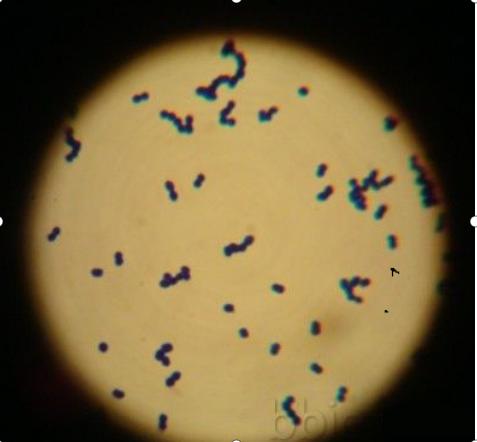 肠球菌在什么情况下会长,肠球菌到底是什么