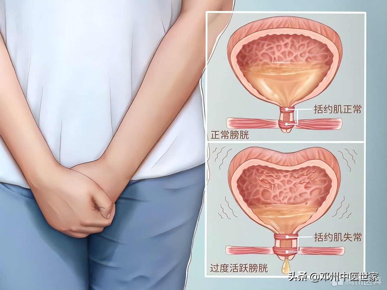 女性尿后漏尿怎么办,女性尿频尿急尿不尽漏尿