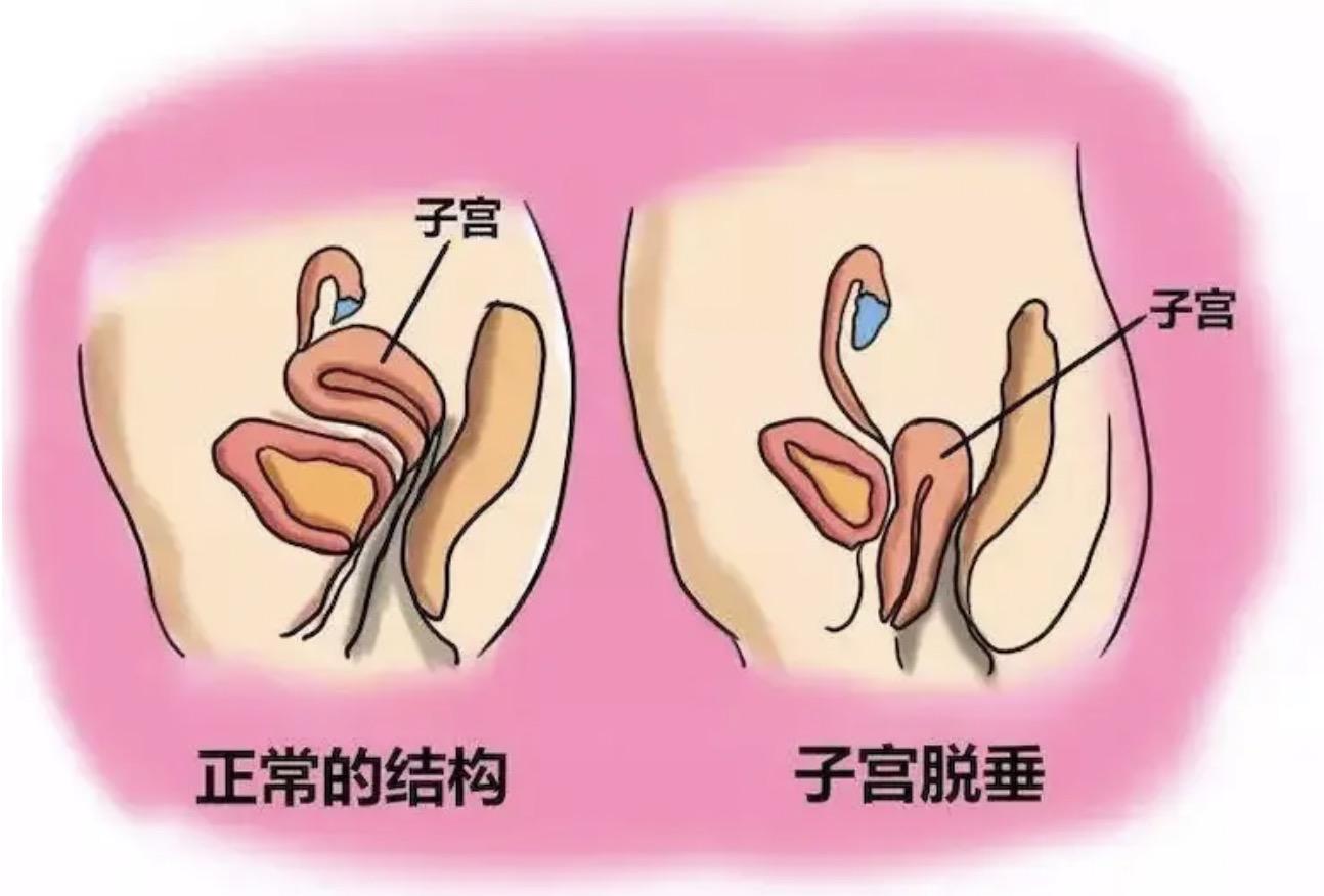 痛苦的疾病治疗,妇科疾病有没有完全治愈的