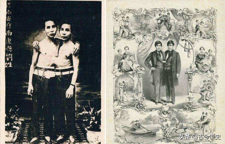 连体人结婚生子,连体人如何生子