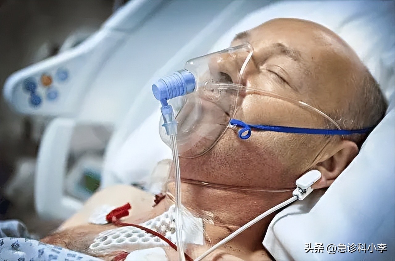 儿童得了脑胶质瘤最多活几年,脑胶质瘤患者的真实就医经历