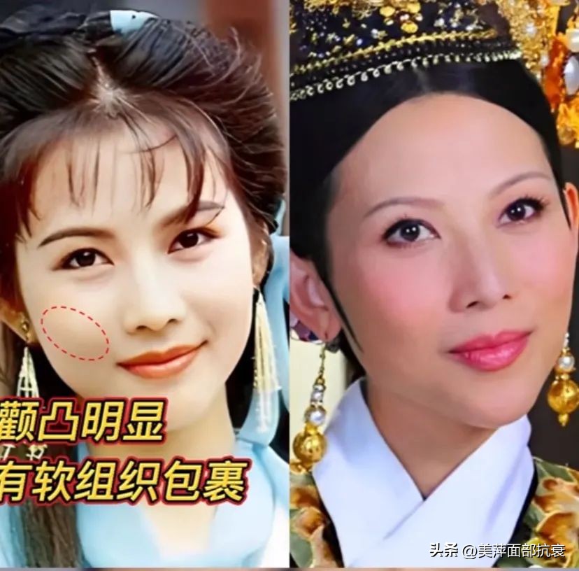 中庭长怎么避免显老,中庭长怎么改善