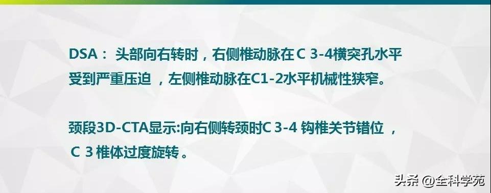 条件反射性眩晕,一种莫名的眩晕