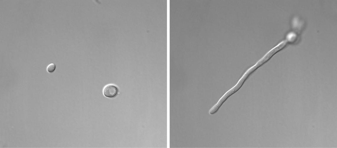 金黄色葡萄球菌的微生物特性,金黄色葡萄球菌的培养特性