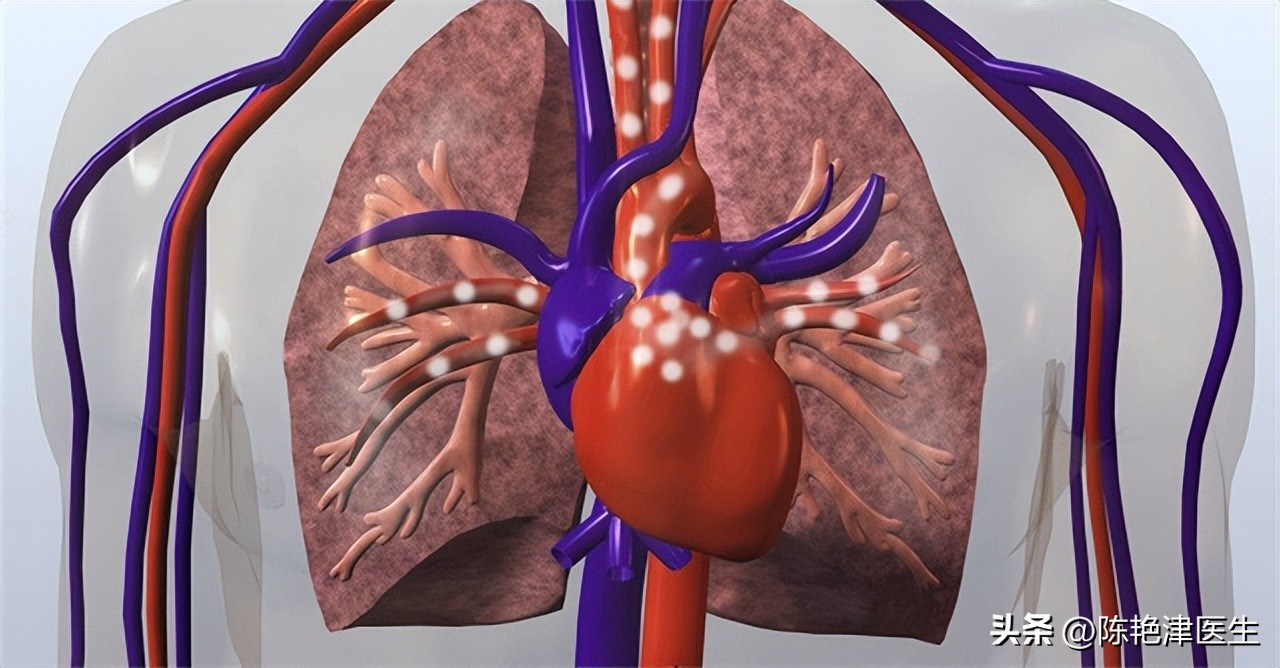 为什么医生不肯说肺大泡有多大,体检肺大疱是什么意思