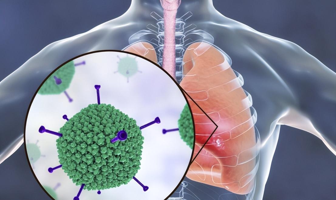 后疫情健康深度逻辑:阳康CT检套餐成兔年“硬通货”