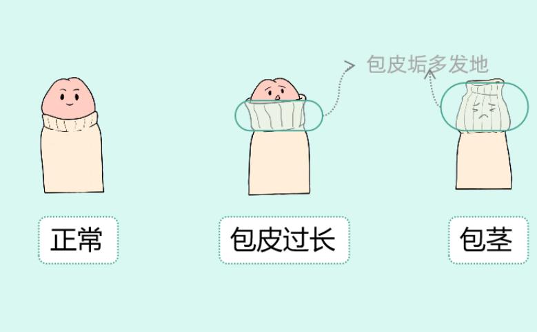 你知道:男性丁丁的发育变化是怎样的吗?如有3大异常及时就医