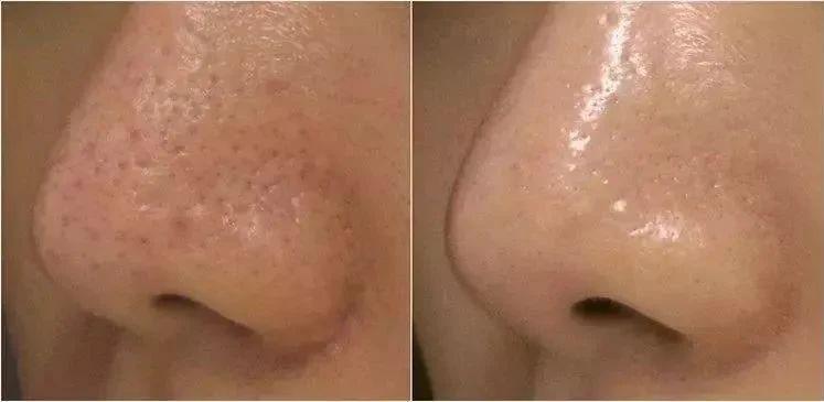 vidivici蚕丝美白保湿洗面奶,vidivici洗面奶和香奈儿洗面奶