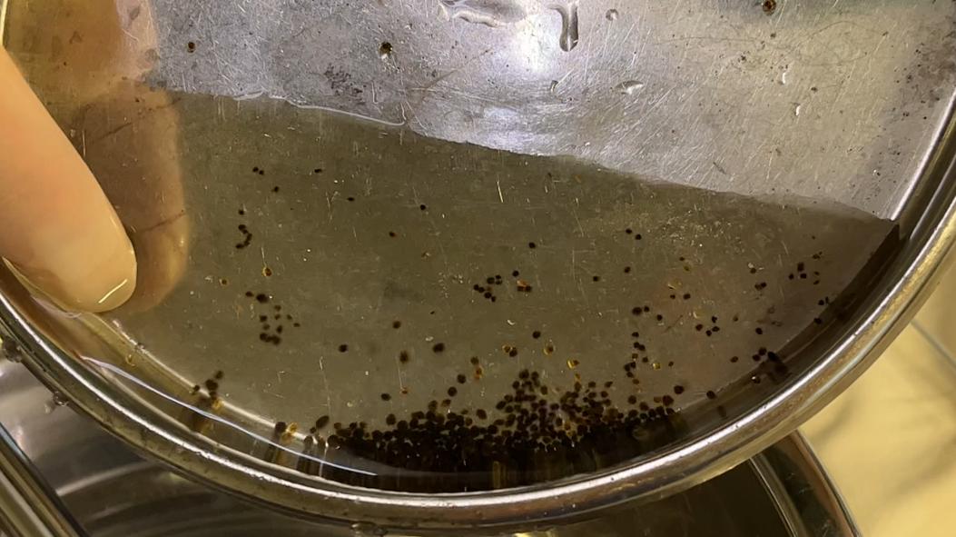 胆结石保胆取石哪家医院做的最好,四川胆结石医院排名