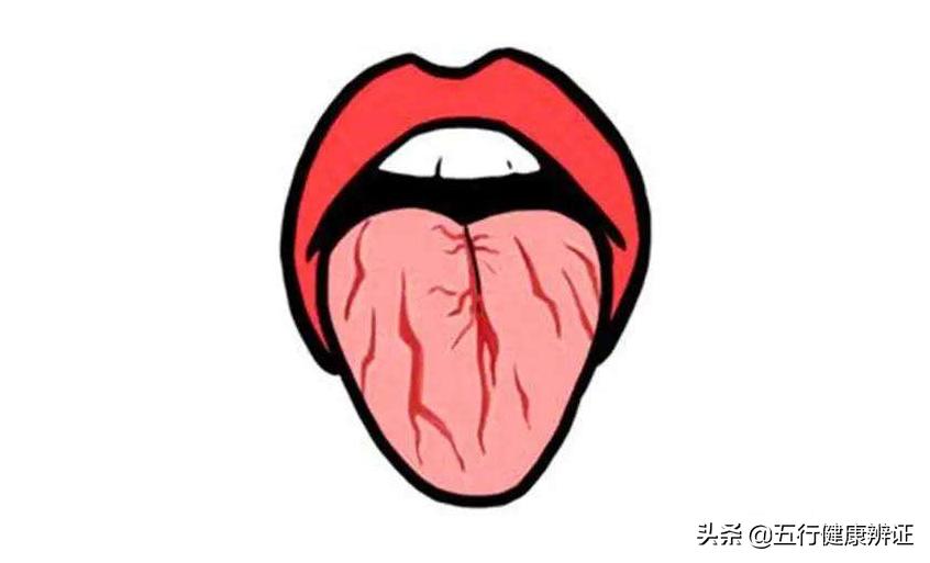 萎缩性慢性胃炎上腹辣疼,萎缩性胃炎胃灼热后背灼热