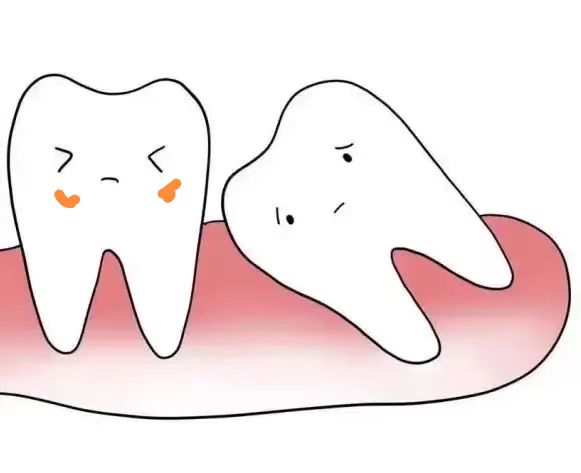 意外摔掉门牙怎么赔偿,意外磕掉牙齿怎么处理