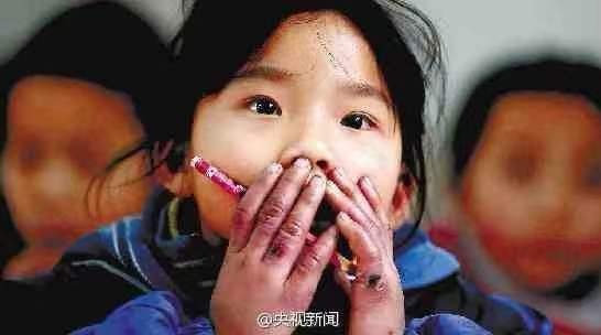 冻疮年年溃烂怎么治,冻疮又痒又肿怎么办