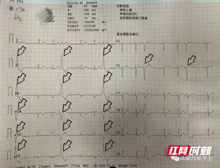 张家界医院可以做手术吗,张家界人民医院可以做激光手术吗