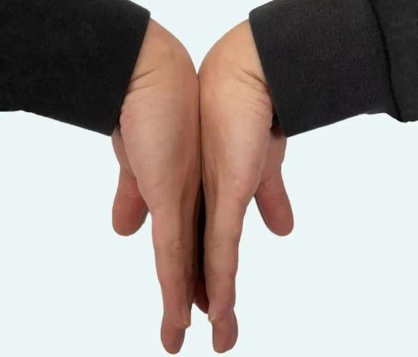 人体肌肉萎缩有哪些症状,右手肌肉萎缩用什么鼠标