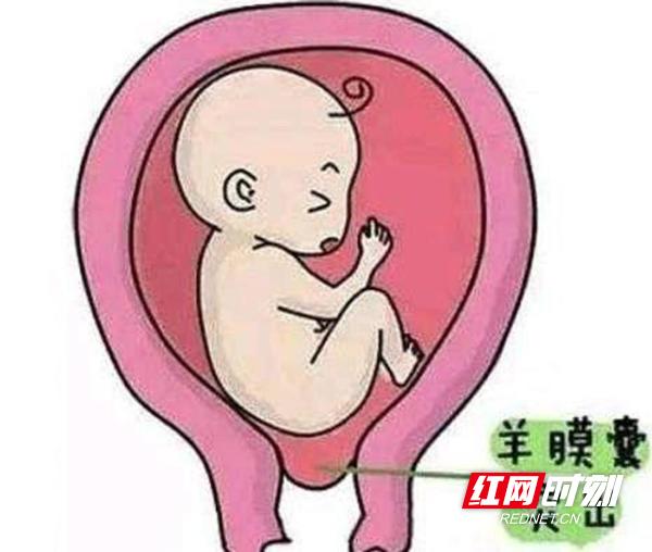 延迟生孩子的奇迹,延迟分娩16天