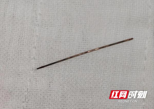 株洲市三三一医院：绣花针为何扎入背部小孙子竟是“刺客”