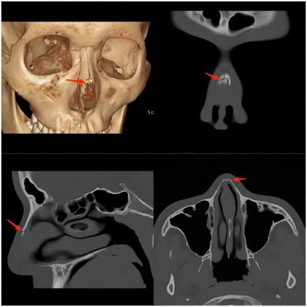 运动损伤知识科普宣传内容,关于足球运动损伤调查问卷