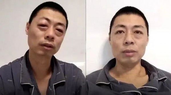 闃充簡涔嬪悗鑸屽ご鍙橀粦,闃充簡浠ュ悗鑸屽ご鍙橀粦