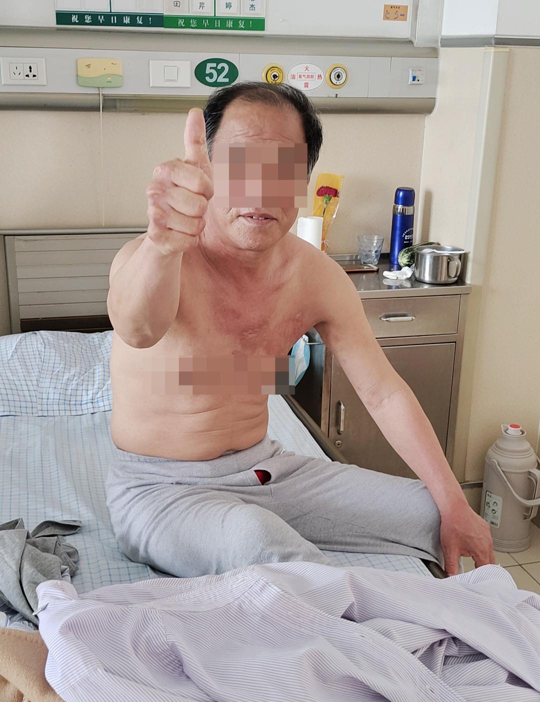 脊髓神经调控技术治疗瘫痪,最新技术治疗中枢神经