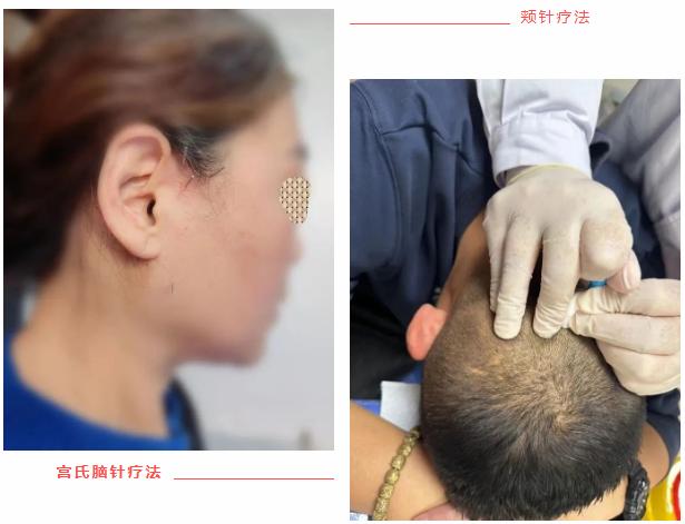 拯救“失眠星人”，潍坊市人民医院顽固性失眠门诊开诊